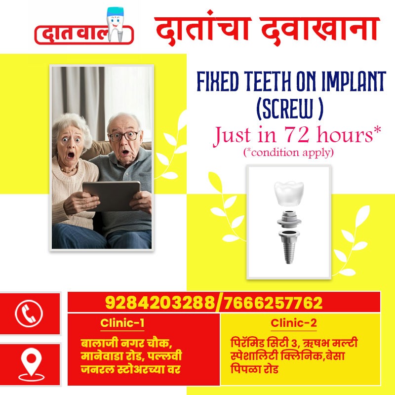 Dental Implants
